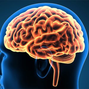 Fonksiyonel-norosiruji