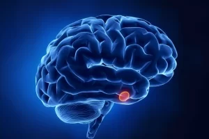 Hipofiz Bezi Tümörü