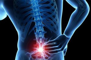 Bel Kayması Spondilolistezis