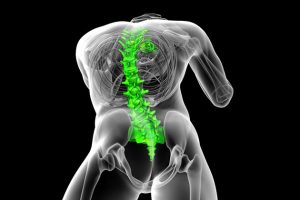 Gergin Omurilik Sendromu