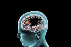 Hareket Bozuklukları Cerrahisi