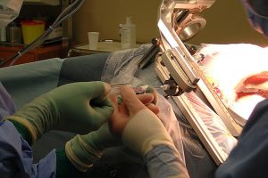 Stereotaksik Cerrahi