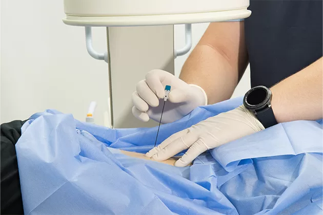 epidural-enjeksiyon